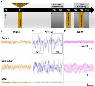 Neonatal Ketamine Alters High-Frequency Oscillations and Synaptic Plasticity in the Subiculum But Does not Affect Sleep Macrostructure in Adolescent Rats